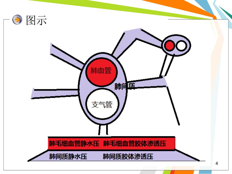 肺水肿的影像学表现（课堂PPT）_第4页