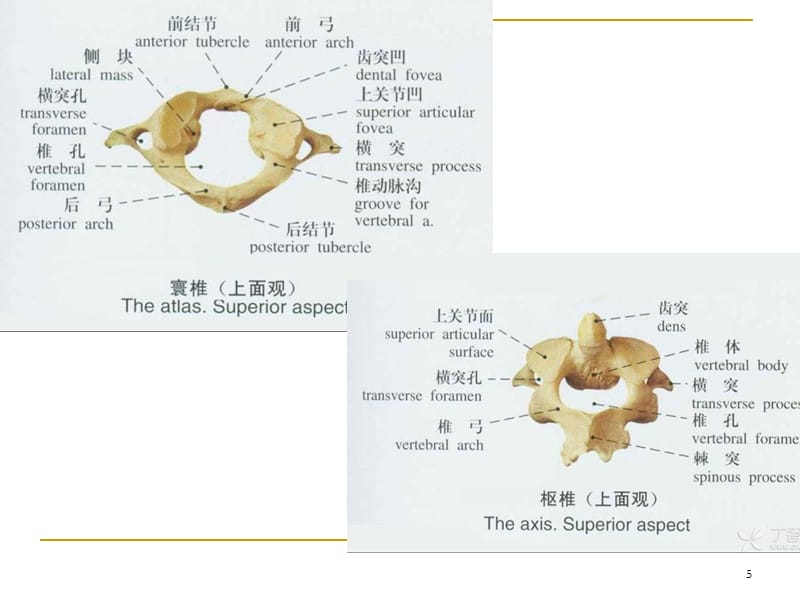 颈椎病X线诊断（课堂PPT）_第5页