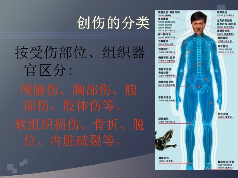 创伤分类及急救基础（课堂PPT）_第3页