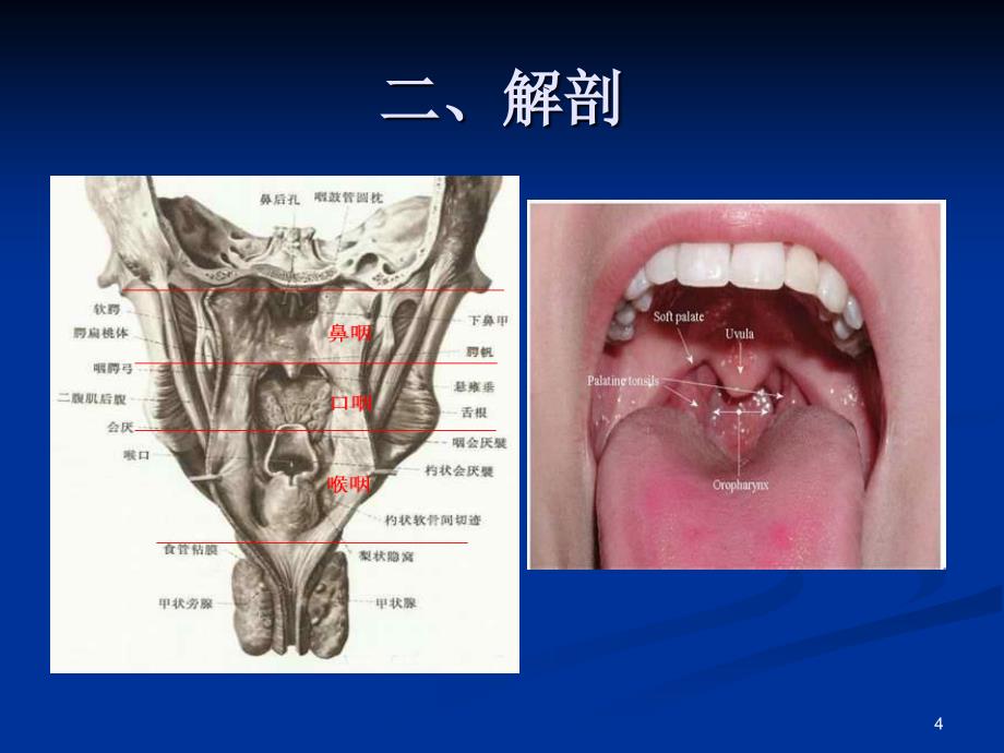 咽部异物-临床图片及经验总结（课堂PPT）_第4页