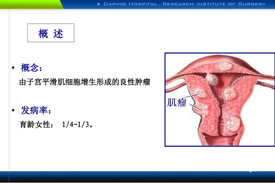 子宫肿瘤PPT_第4页