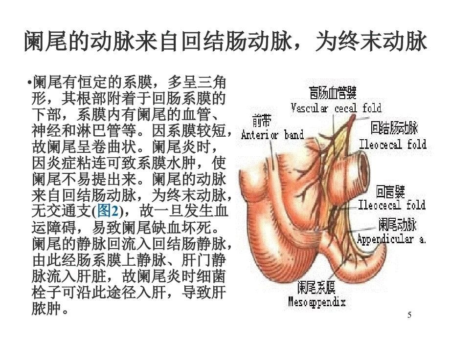 阑尾切除术图解PPT_第5页