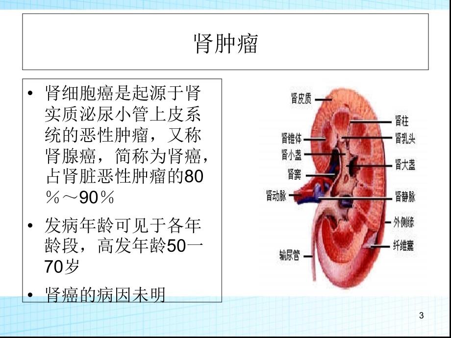 泌尿系统肿瘤(图文)PPT_第3页