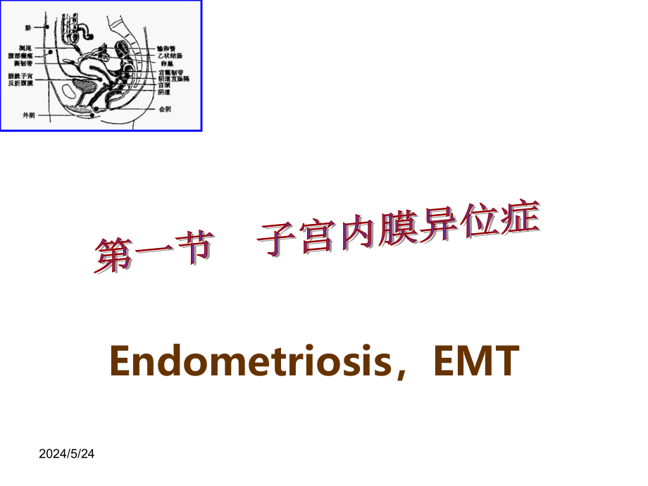 (完成)子宫内膜异位症ppt2301_第3页