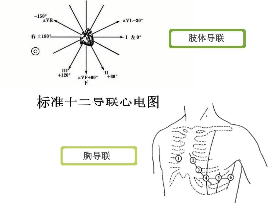 循环系统疾病病人护理心律失常 -PPT文档课件_第5页