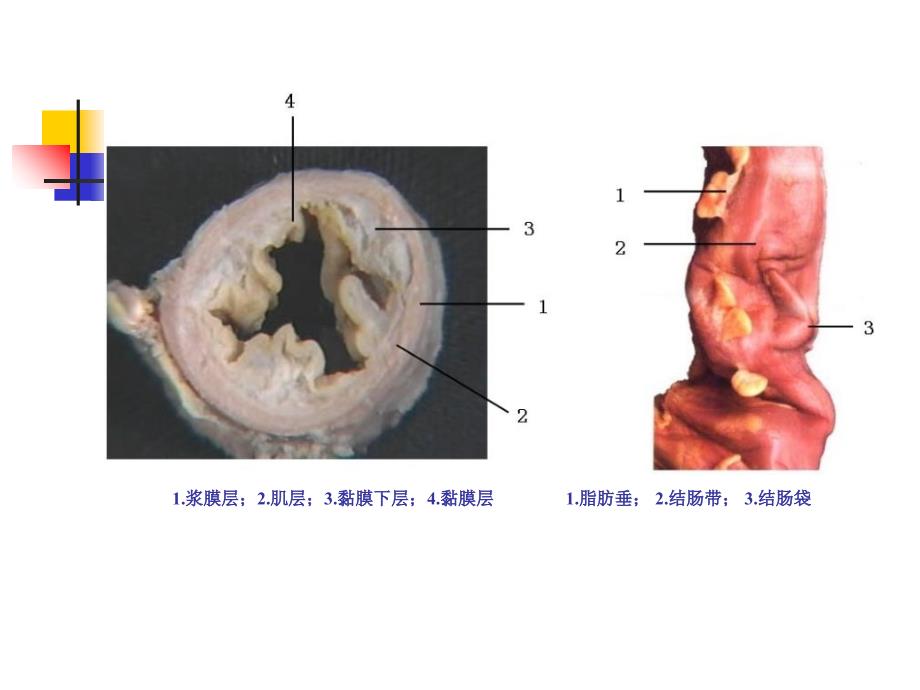 结肠、直肠肛管疾病教学教案_第3页