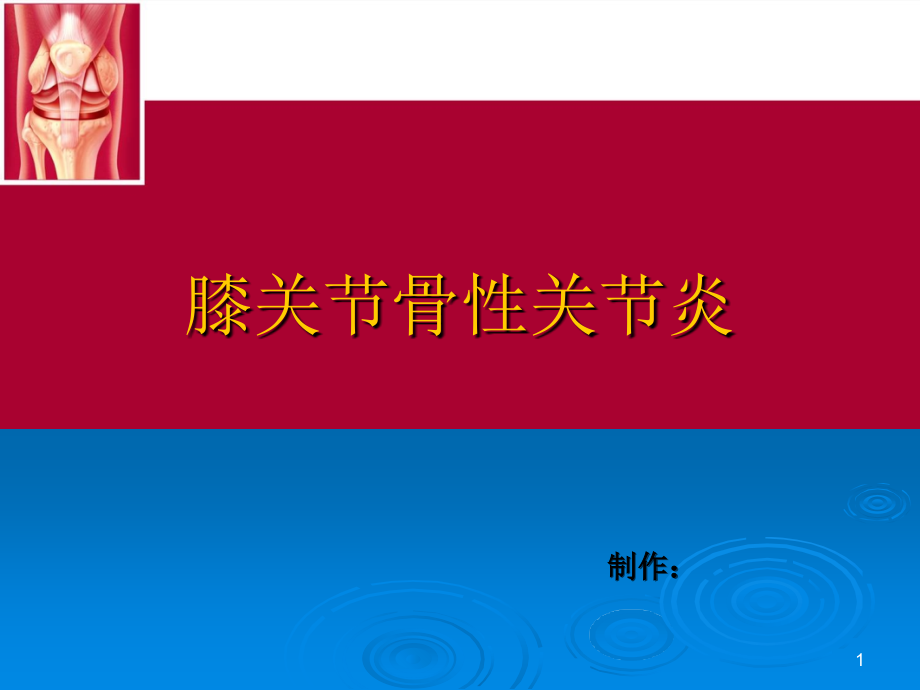 膝关节骨性关节炎-文档资料_第1页