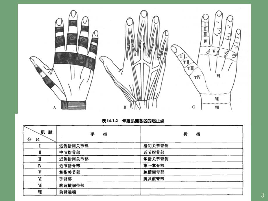 支具在锤状指康复中的应用55468-文档资料_第3页