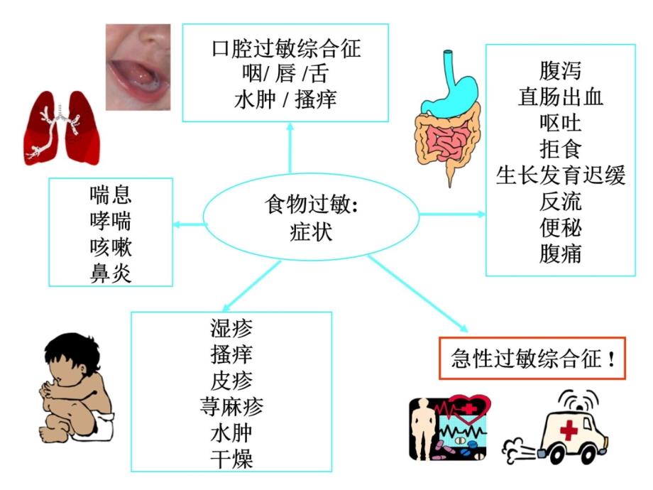 牛奶蛋白过敏研究知识课件_第4页