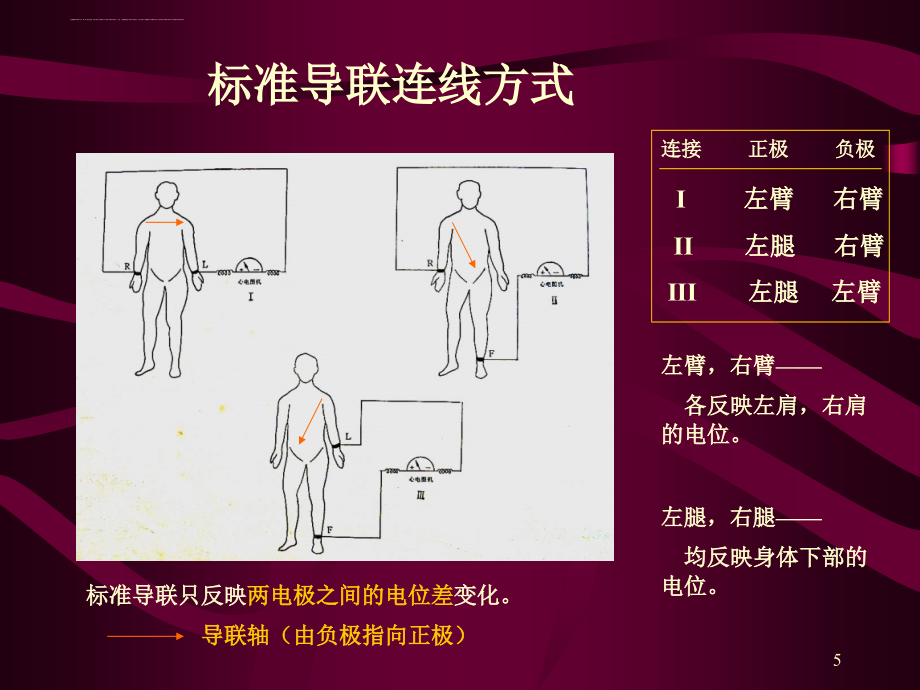 心电图 心电向量与心肌缺血课件_第4页