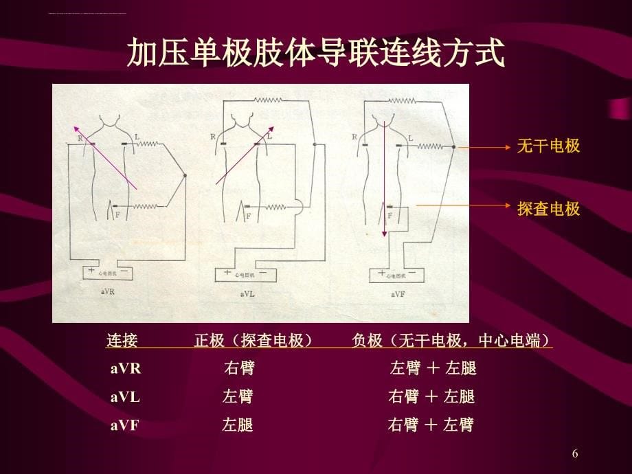 心电图 心电向量与心肌缺血课件_第5页