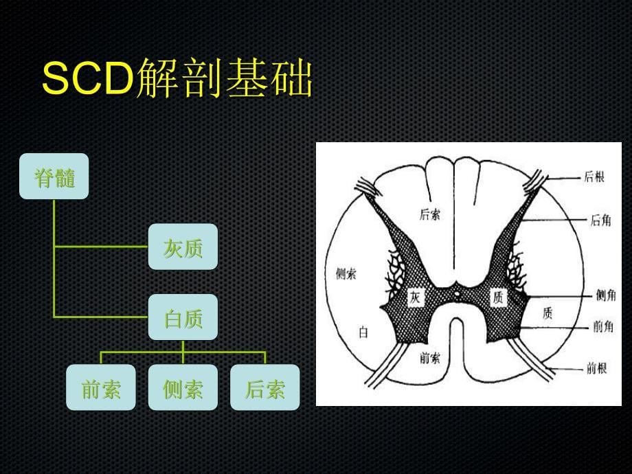 亚急性联合变性的MRI诊断-文档资料_第5页