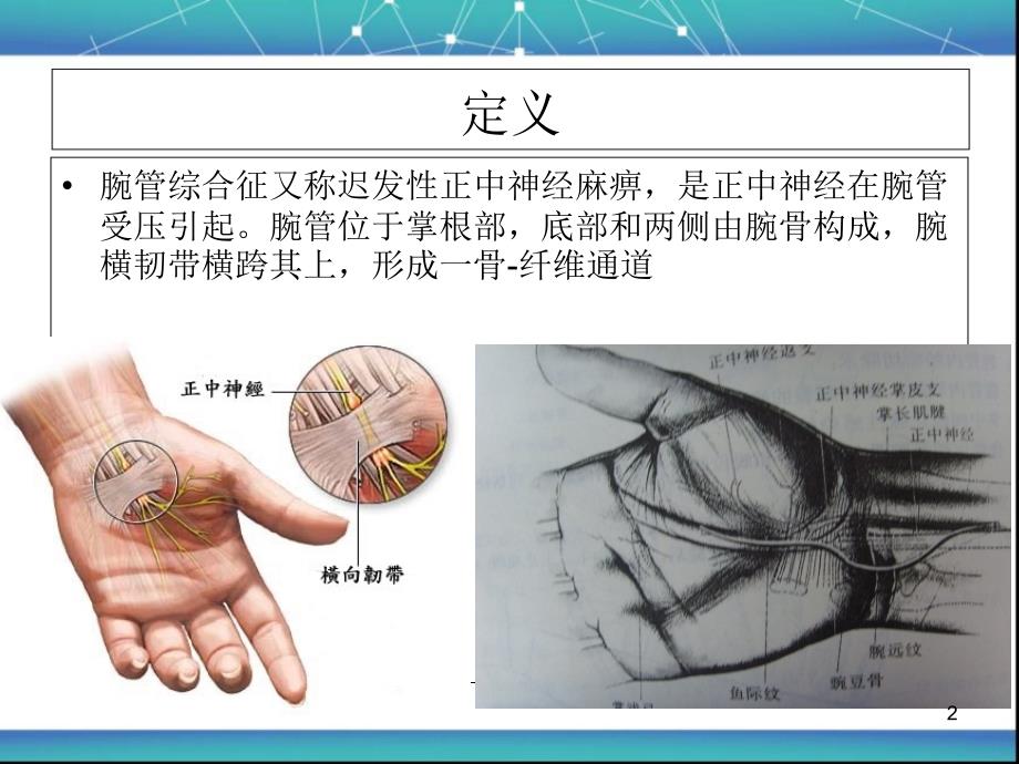 腕管综合症 护理查房-文档资料_第2页