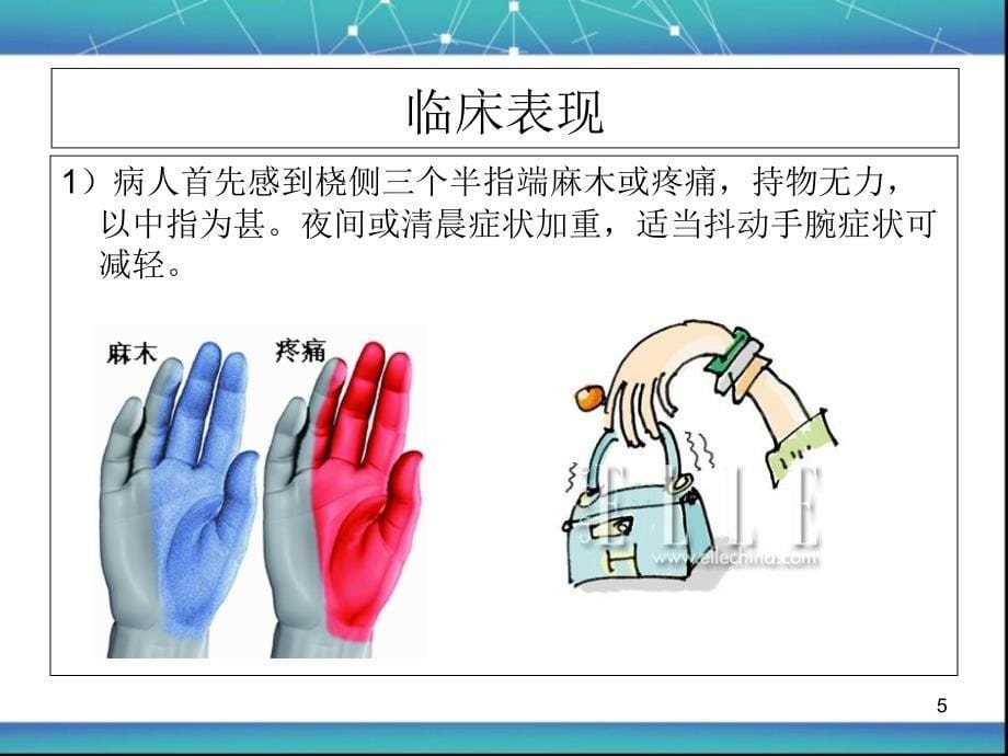 腕管综合症 护理查房-文档资料_第5页