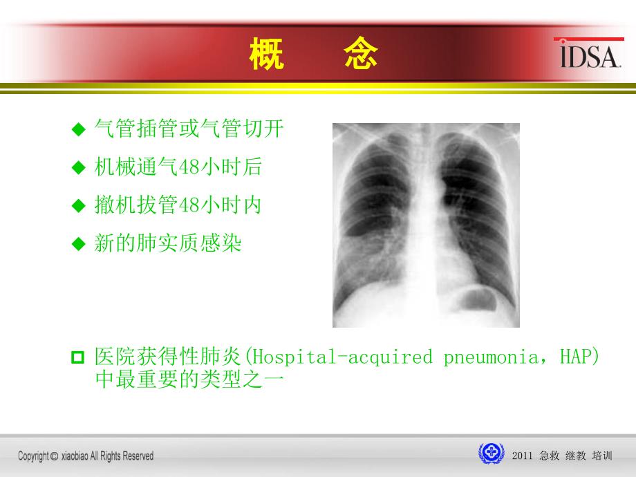 2011呼吸机相关性肺炎课件_第3页