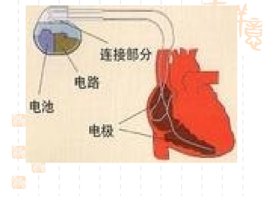 第二章心脏起搏器课件_第4页