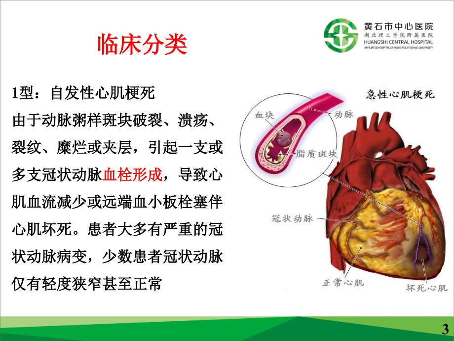 急性心肌梗死与再灌注治疗-文档资料_第3页