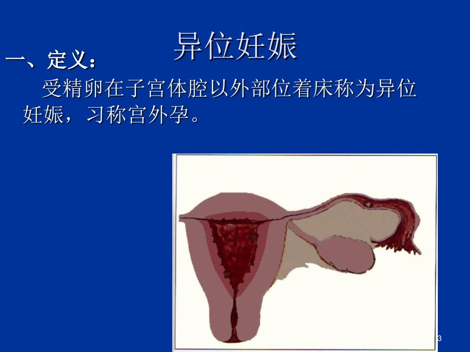 异位妊娠失血性休克的急救与护理-文档资料_第3页