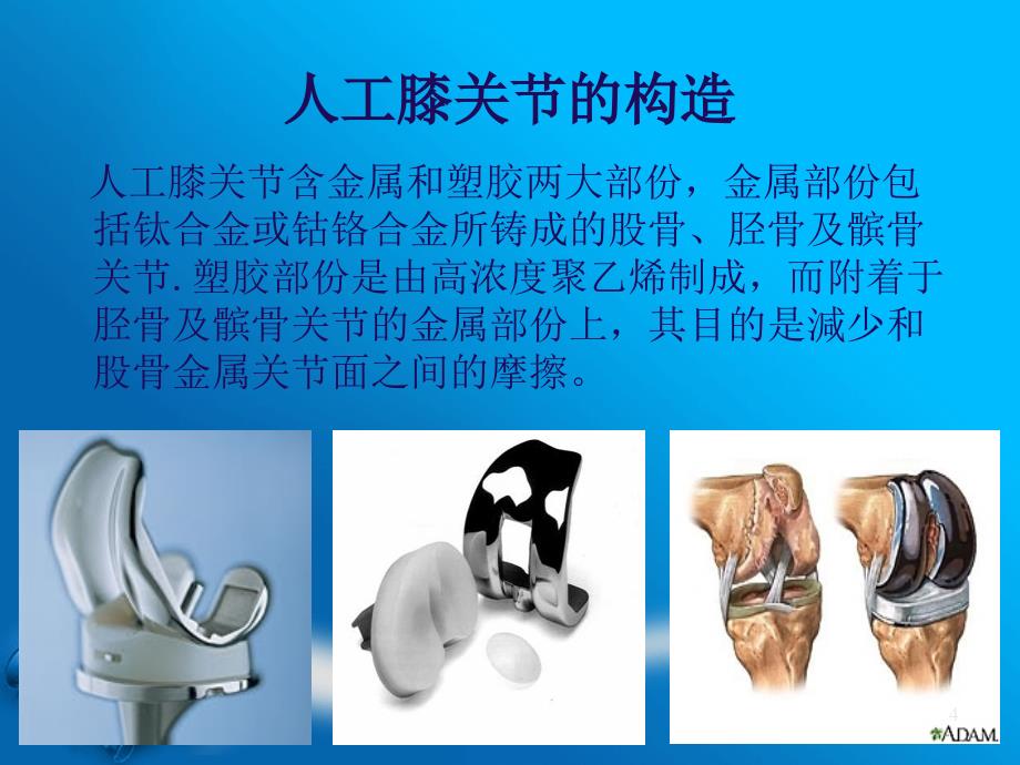 人工全膝关节置换术-文档资料_第4页