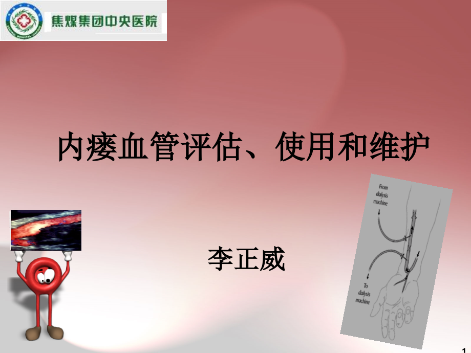 李正威内瘘血管评估使用和维护-文档资料_第1页