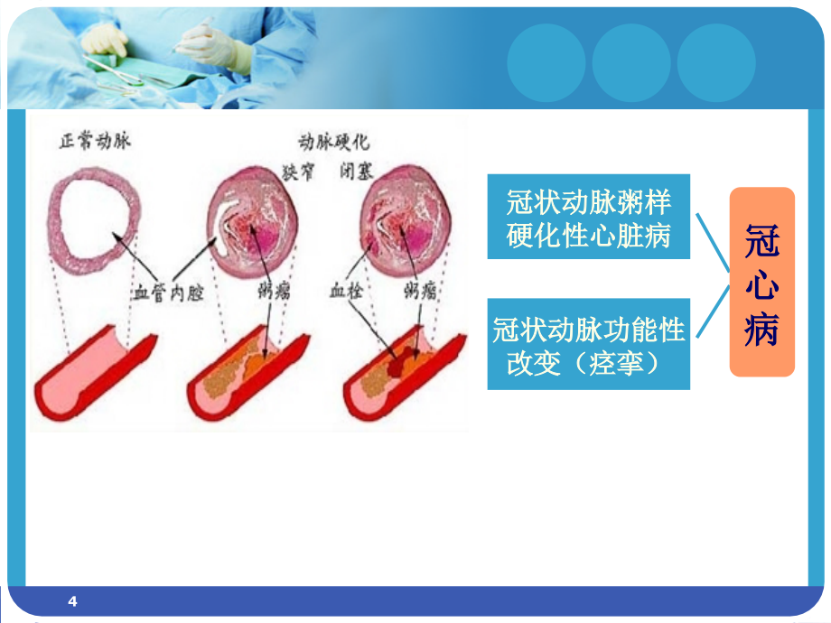 冠状动脉粥样硬化性心脏病人的护理-文档资料_第4页