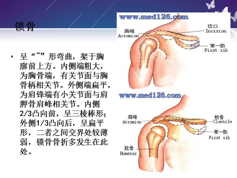 锁骨骨折切开内固定除术护理查房-文档资料_第2页