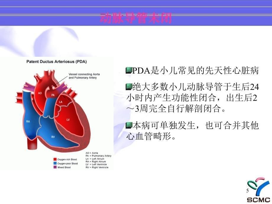 先心病手术时机和手术方法-文档资料_第5页