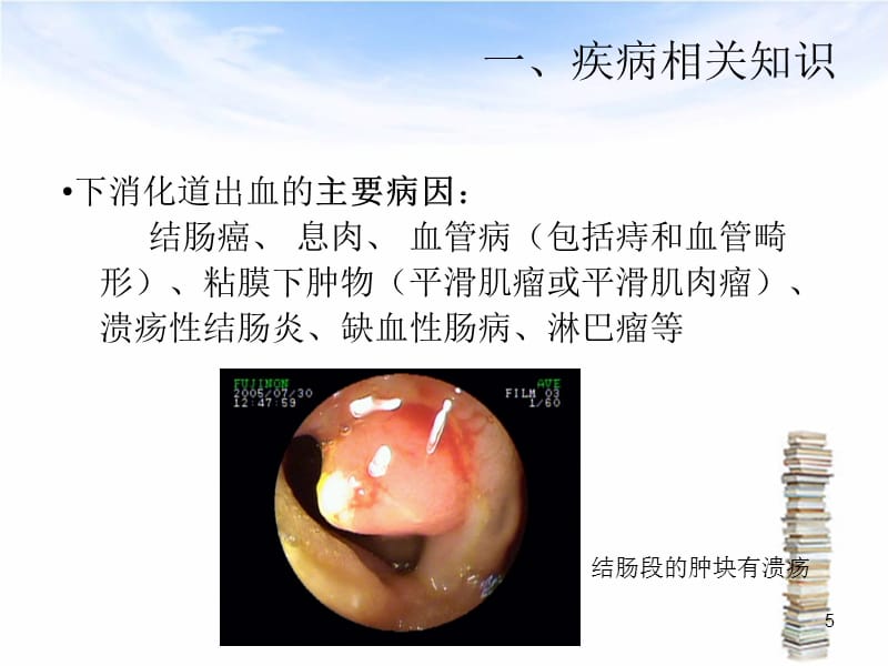 下消化道出血伴失血性休克护理查房-文档资料_第5页