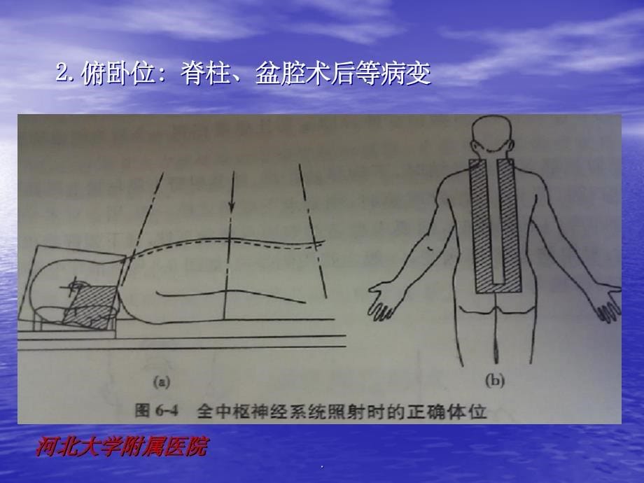 临床常用照射技术ppt课件_第5页