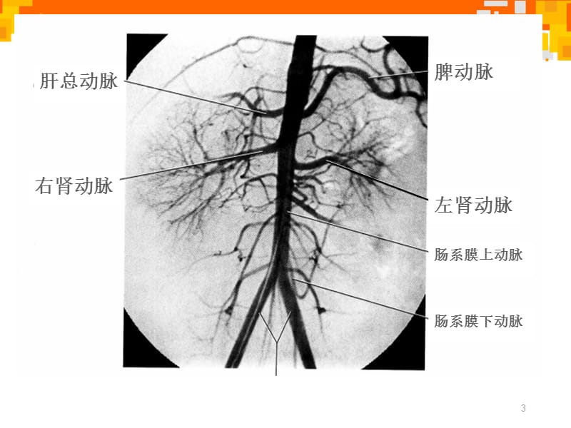 腹部血管解剖与变异-文档资料_第3页