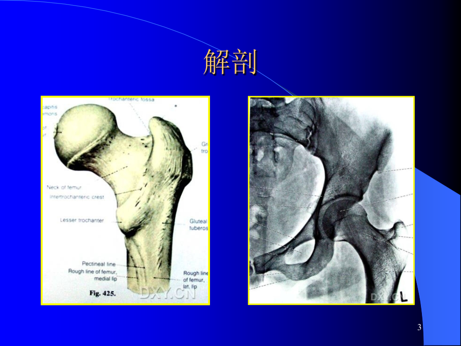 股骨转子间骨折(定稿)-文档资料_第3页