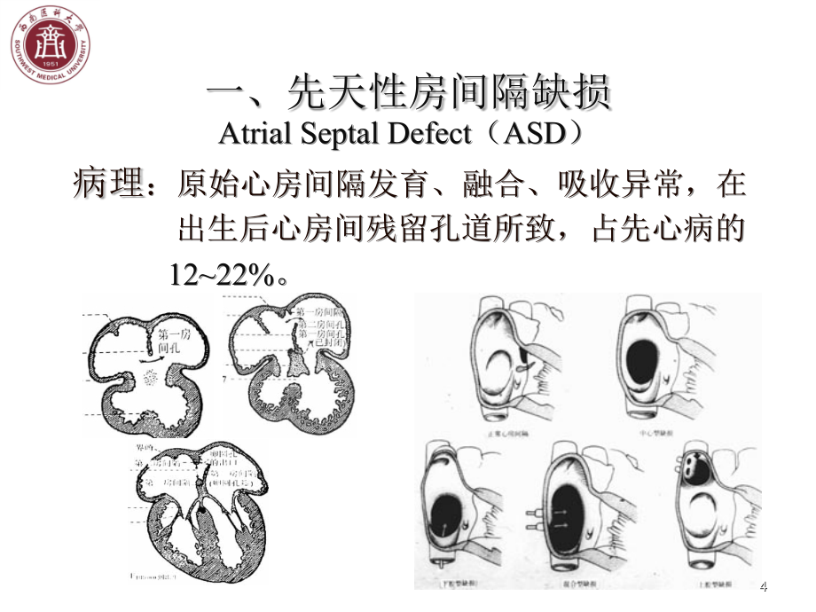 心血管系统病变影诊断(心脏先天性和其它血管疾病)-文档资料_第4页