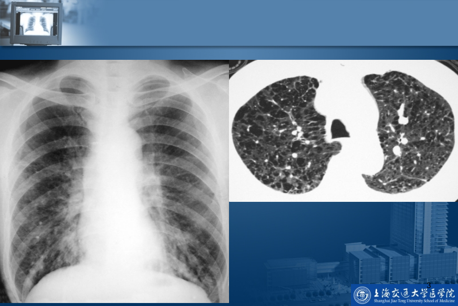 呼吸系统影像学诊断-文档资料_第3页