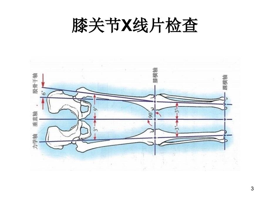 膝关节X线片检查-文档资料_第3页