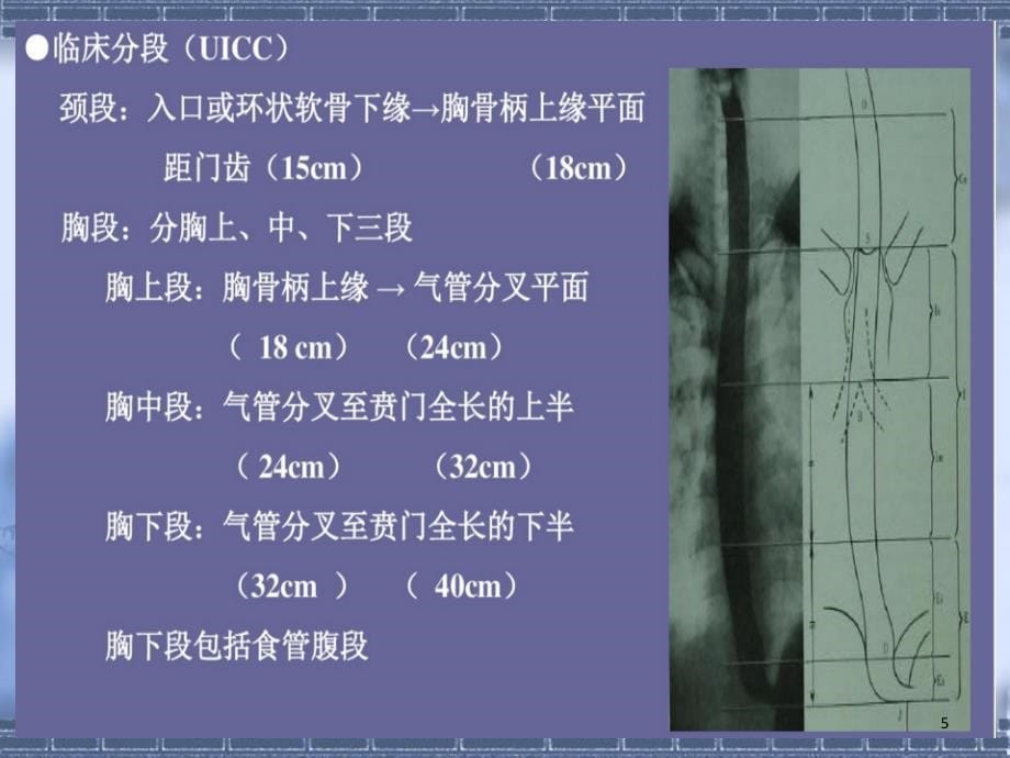 食管肿瘤的影像诊断-文档资料_第5页