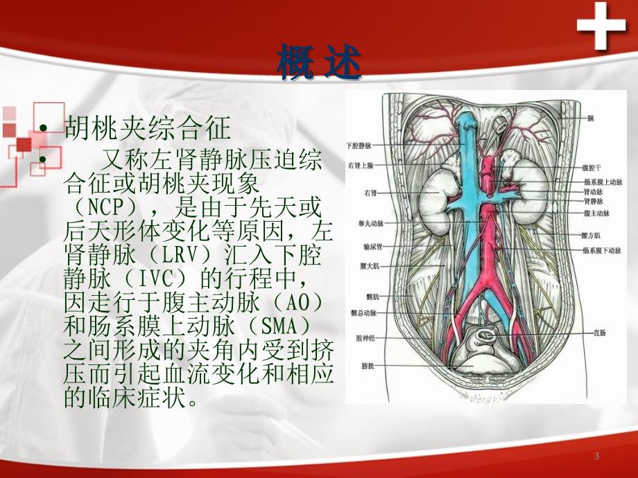 胡桃夹综合征-文档资料_第3页