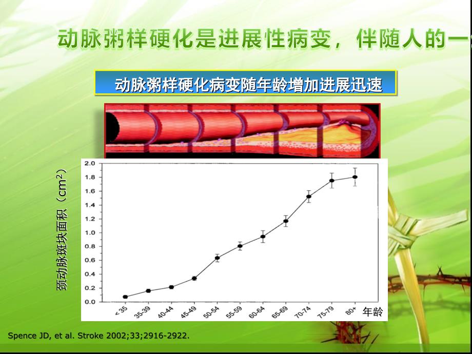 动脉粥样硬化的发生机制PPT_第3页