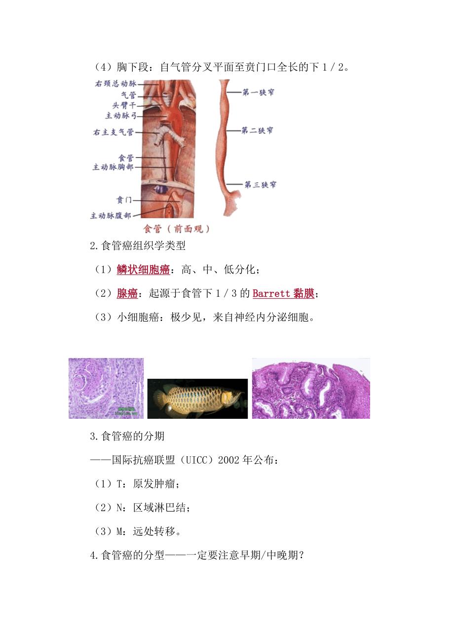 2017年临床助理医师资格考试辅导课件《消化系统》食管癌讲义_第2页