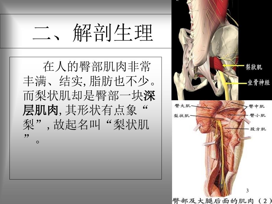 梨状肌综合征课件-文档资料_第3页