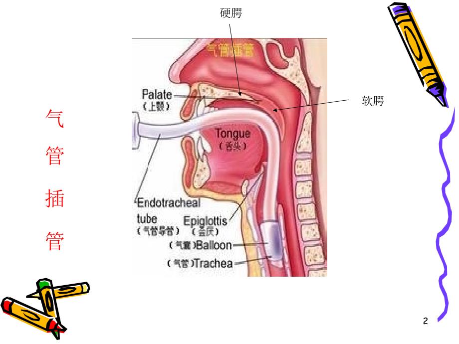 气管插管-文档资料_第2页