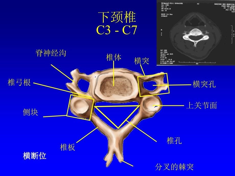 环枢椎不稳及脱位的诊治-文档资料_第5页