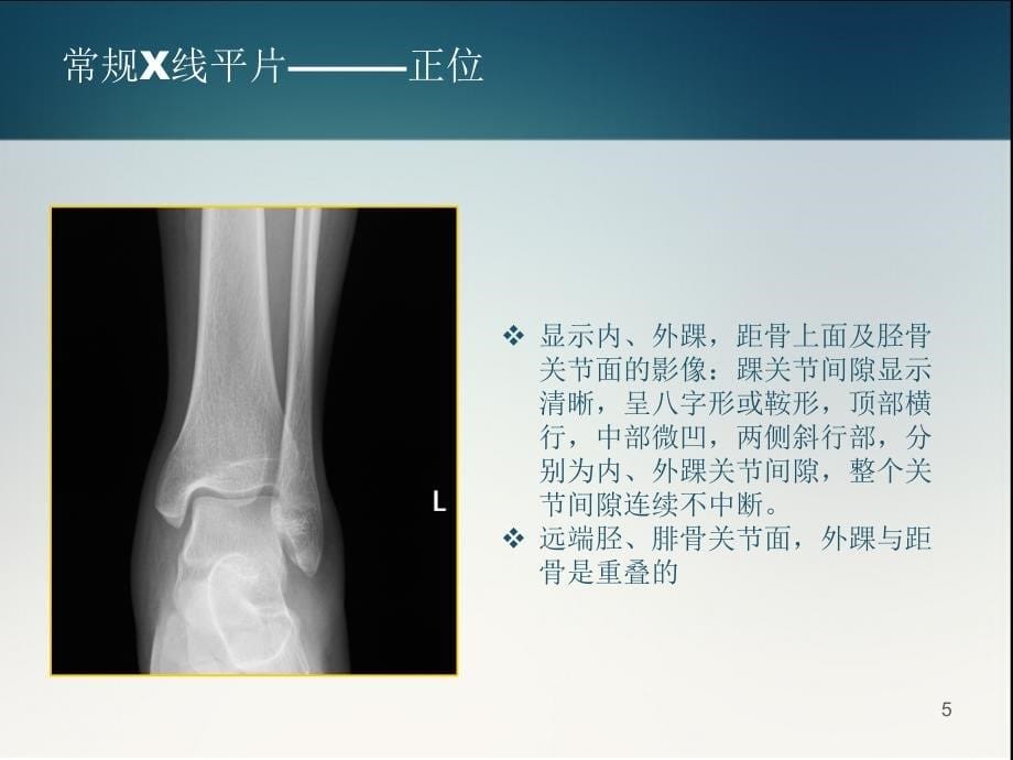 踝关节正常解剖和损伤性病变的影像表现-文档资料_第5页