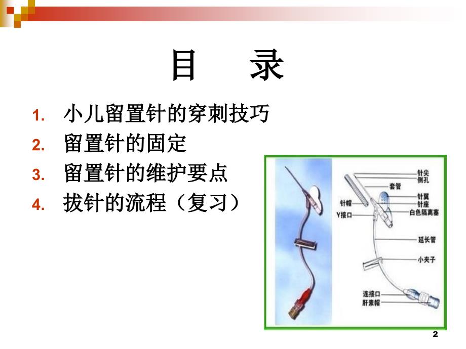 小儿留置针的穿刺技巧固定与维护-文档资料_第2页