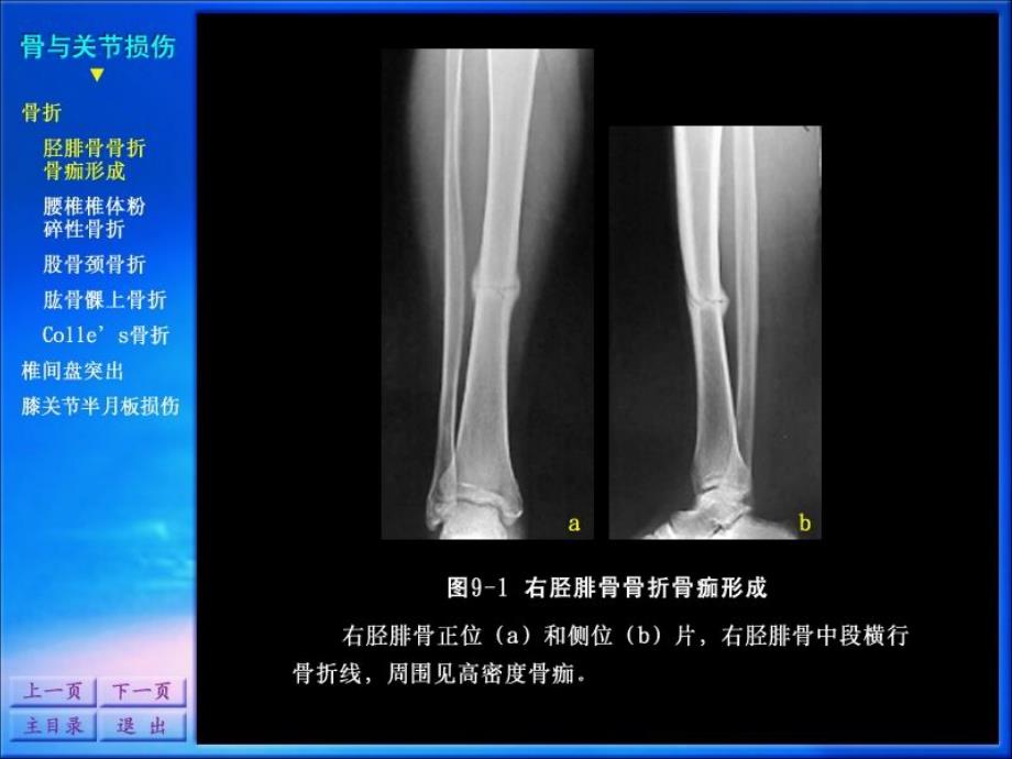 影像诊断学系列图谱骨骼系统课件_第2页