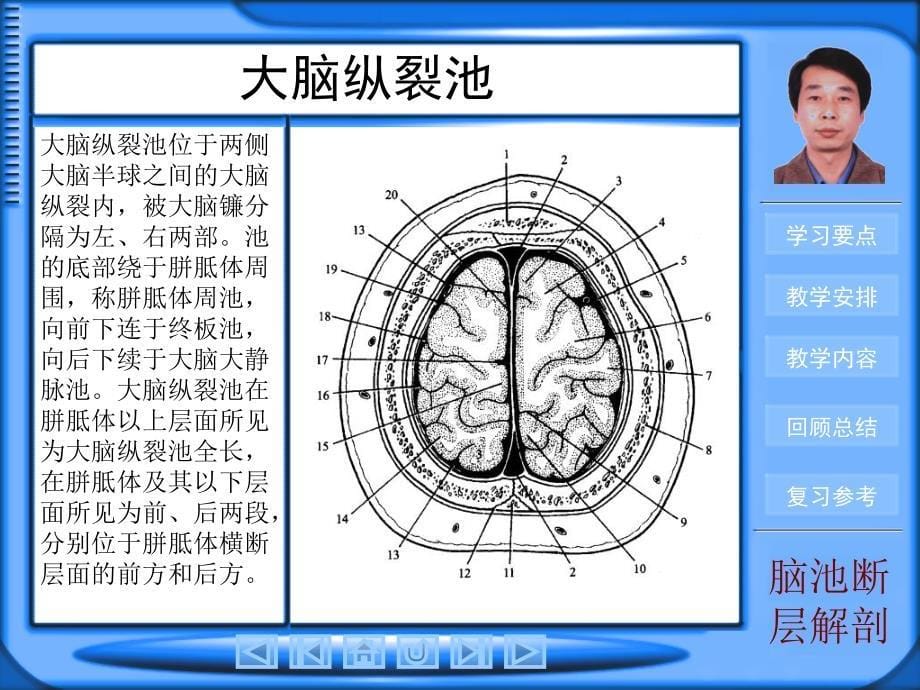 脑池断层影像解剖复习课程_第5页
