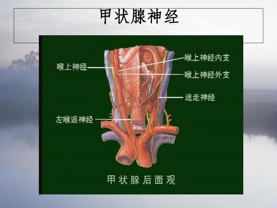 腔镜甲状腺术后病人的护理查房ppt课件_第5页