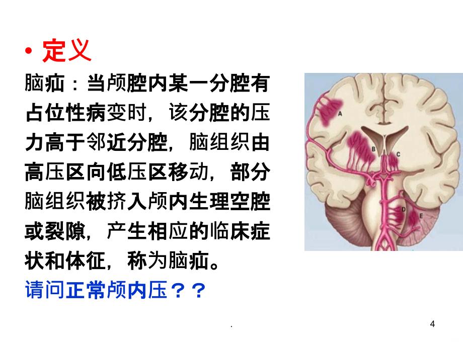 脑疝护理幻灯片PPT课件_第4页