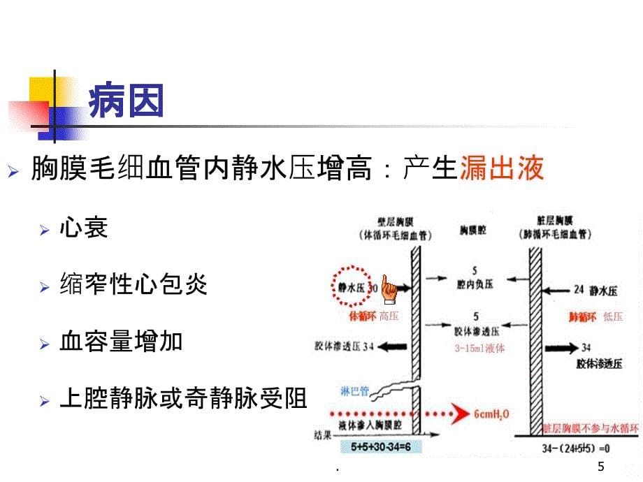 胸腔积液 - 副本PPT课件_第5页