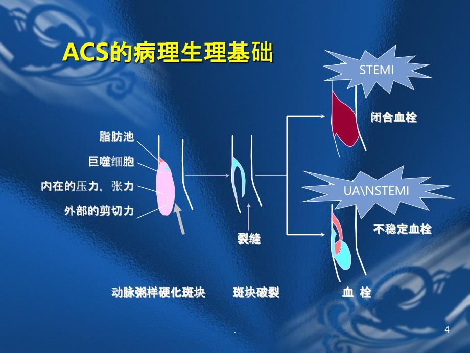 ACS的药物治疗PPT课件_第4页