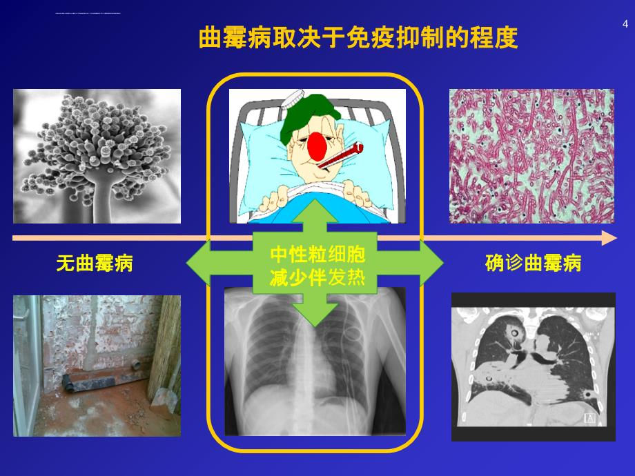 伏立康唑治疗男慢性阻塞性肺病（COPD）患者的曲霉病Meersseman W中文2011课件_第4页